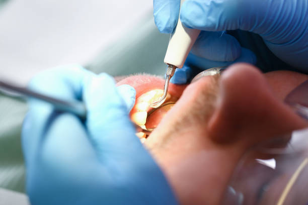 Best Holiday Emergency Dentist in Camp Springs, MD