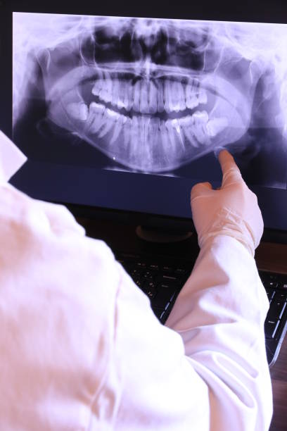 Best Emergency Dental Care for Abscessed Tooth in Camp Springs, MD