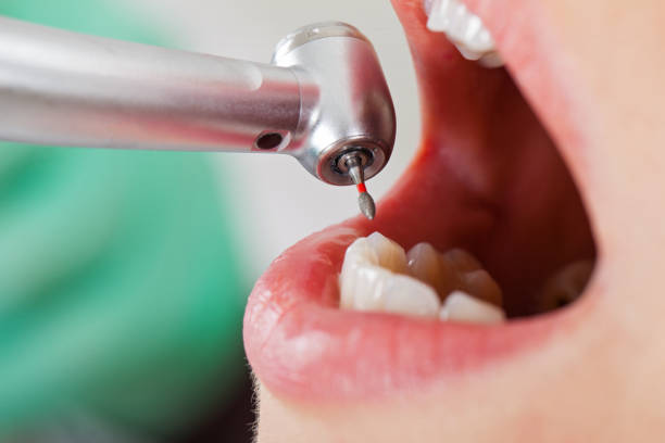 Best Urgent Dental Care for Toothache in Camp Springs, MD